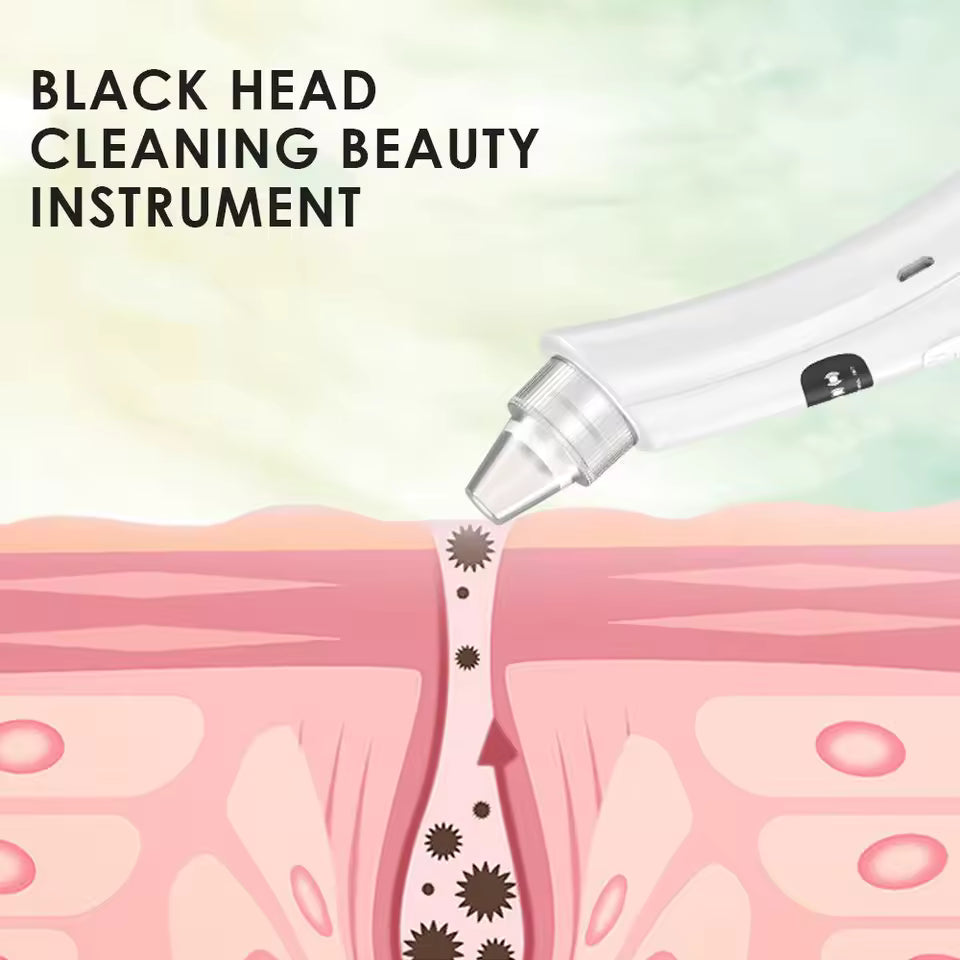 Wiselle PoreCare™ – Rechargeable Pore Vacuum
